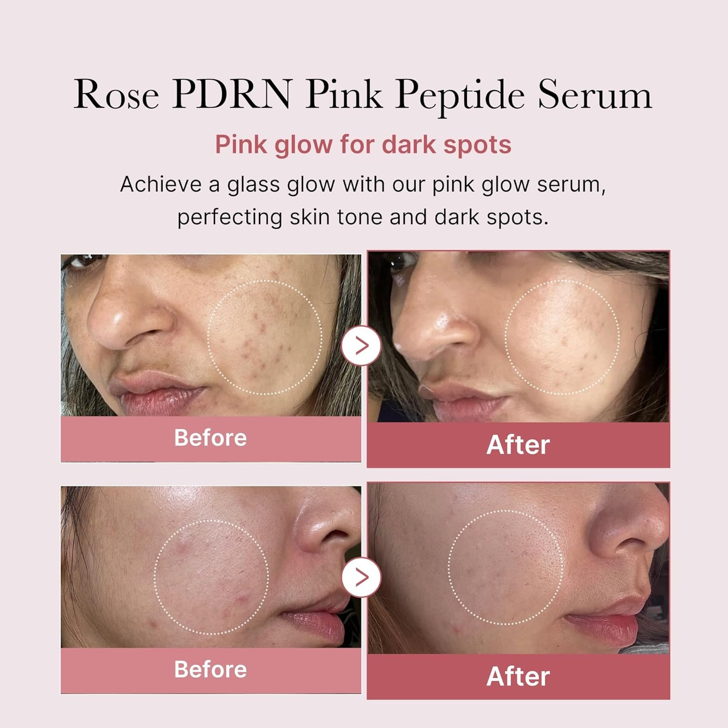 Medicube Pdrn Pink Peptide Serum Pink Serum For Skin Lightening And Anti-Wrinkle - Image 3